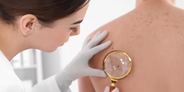 Full Skin Check and melanoma checks