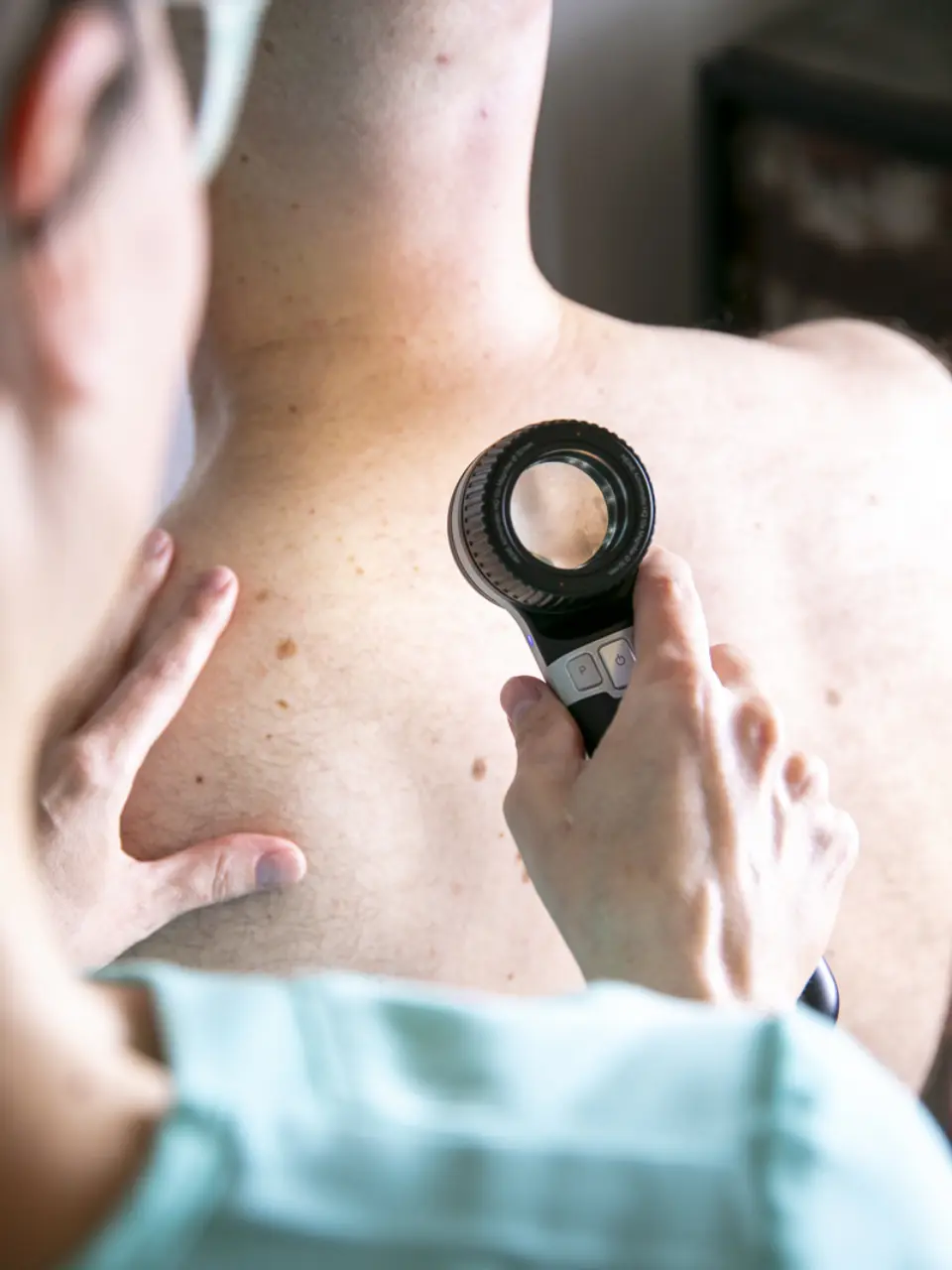 Stay Safe with Regular Cancer Skin Checks