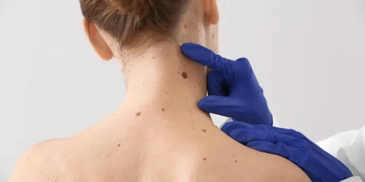 Brisbane Skin Cancer Clinic Services Explained
