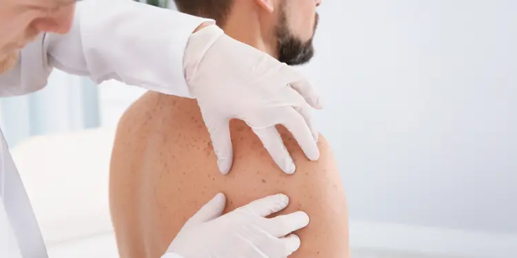 Brisbane Skin Cancer Clinic
